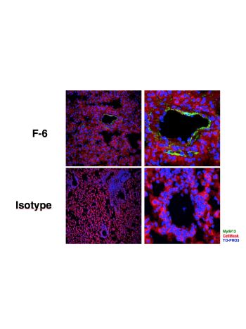 Human/Mouse Myl9/12 (F6) rabbit mAb