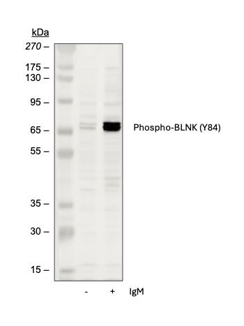 Phospho-BLNK (Tyr84) (H4) rabbit mAb