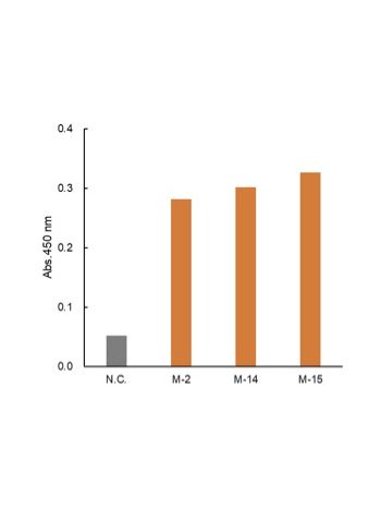 ELISA of recombinant CTX-M subtypes (M-14, M-2, M-15) produced by Escherichia coli with anti-CTX-M (C11) rabbit mAb (Cat. 2626). ELISA of recombinant CTX-M subtypes (M-14, M-2, M-15) produced by Escherichia coli with anti-CTX-M (C11) rabbit mAb (Cat. 2626