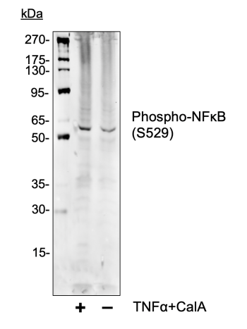 Phospho-NFkB p65 (Ser529) (A2) rabbit mAb