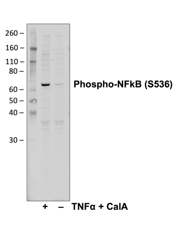 Phospho-NFkB p65 (Ser536) (C8) rabbit mAb